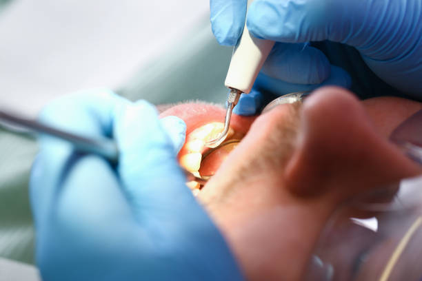 Best Holiday Emergency Dentist in Lampasas, TX