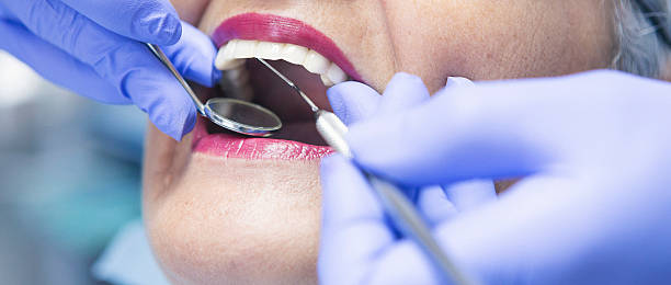 Best Broken or Cracked Tooth Emergency Dentist in Lampasas, TX